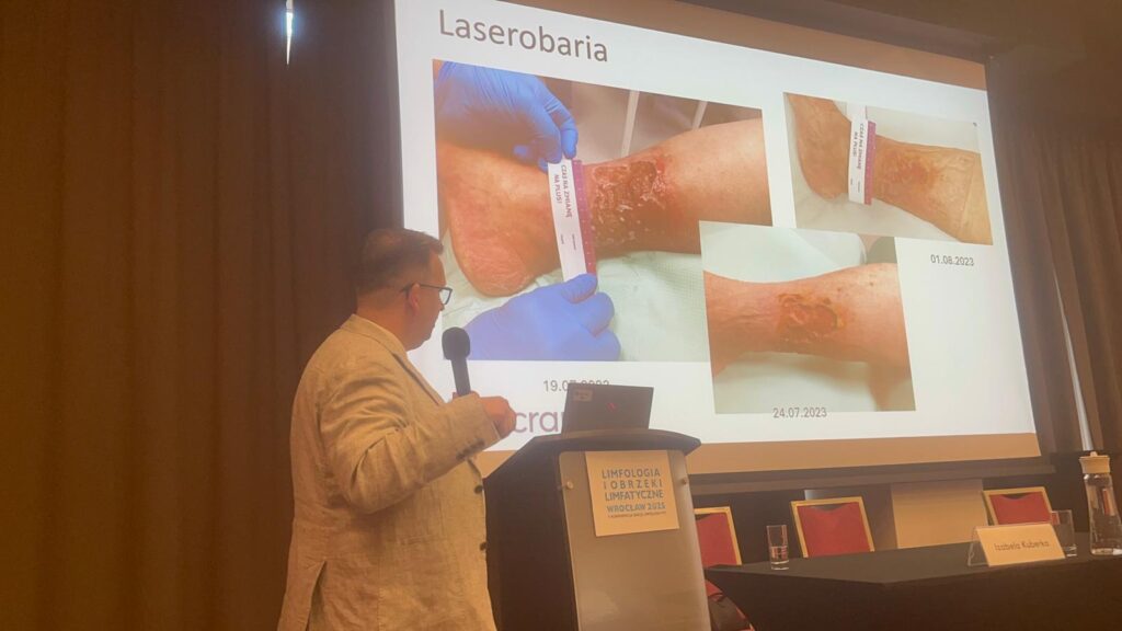 Dr n. med. Konrad Pańczak podczas wystąpienia na V Konferencji Sekcji Limfologii Polskiego Towarzystwa Limfologicznego, prezentujący zastosowanie Laserobarii w leczeniu ran i obrzęków limfatycznych